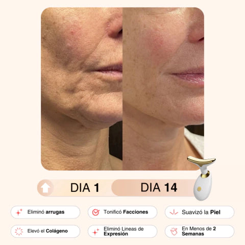 OFERTA 3x1 CUIDADO CORPORAL. MASAJEADOR ANTICELULITIS + REDUCTOR DE PAPADA + ESTIMULADOR DE GLUTEO: DISFRUTA DE TU CUERPO COMO NUNCA ANTES